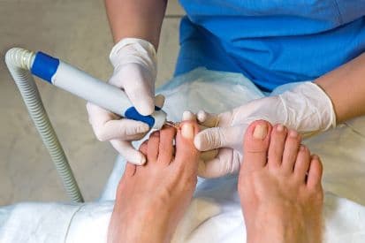 ingrown-toenaiail-removal